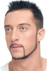 Before a facelift for men Before a facelift for men