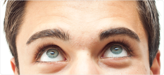Eyelid surgery (Blepharoplasty) for men Eyelid surgery (Blepharoplasty) for men