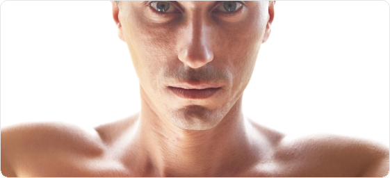 Nose surgery (Rhinoplasty) for men Nose surgery (Rhinoplasty) for men