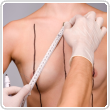 Breast surgery